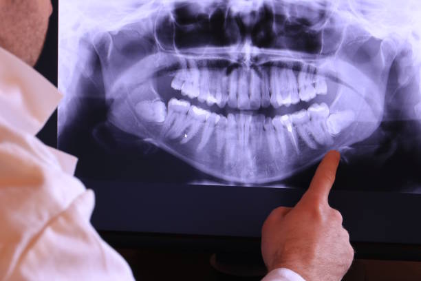 Best Emergency Treatment for Oral Infections in Mound Bayou, MS